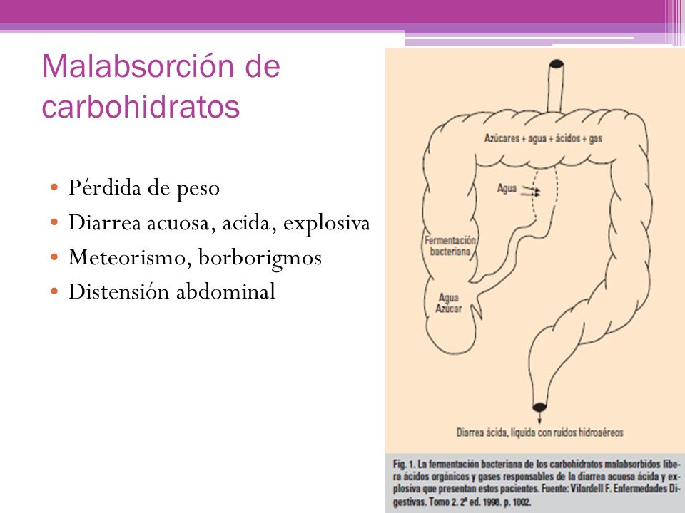 Diarrea liquida perdida de peso